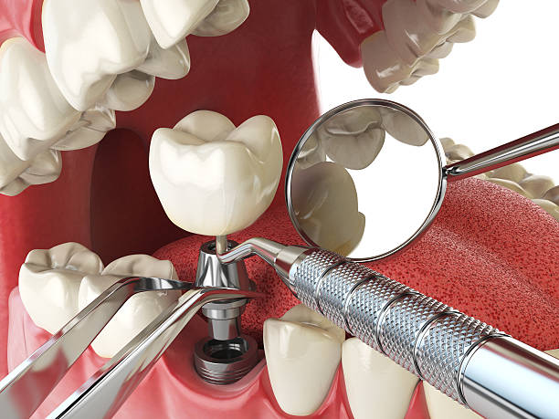 Best Weekend Emergency Dentist in Springboro, OH