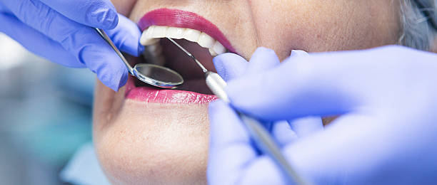 Best Broken or Cracked Tooth Emergency Dentist in Springboro, OH